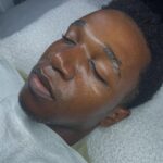 face-treatment